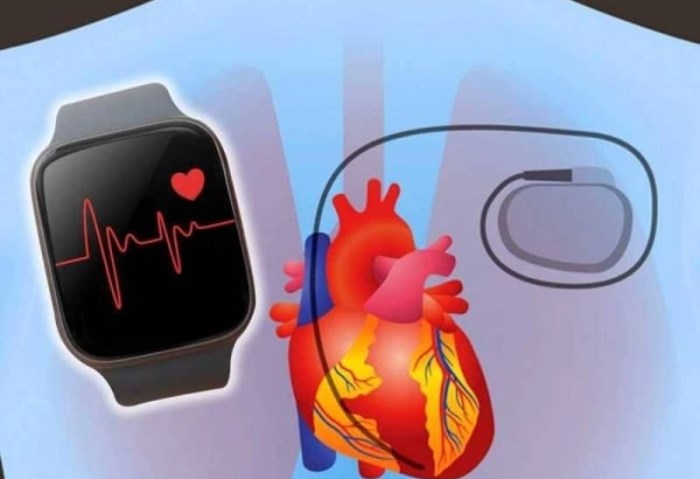 الساعات الذكية