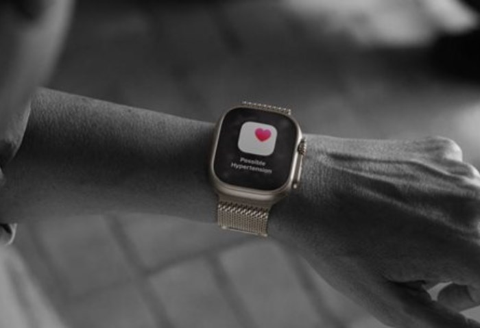 ساعة آبل Watch Ultra 3